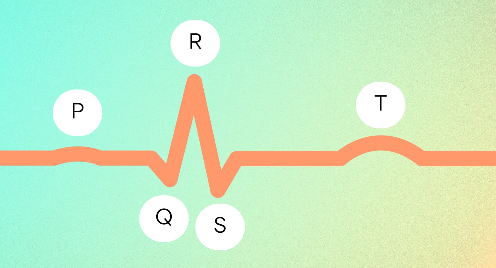 One cardiac cycle. When this cycle is repeated over and over again, a cadence is formed.